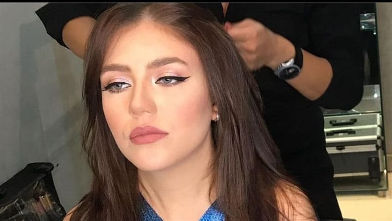 بعد مأساة رحمة حسن.. «ترند ميديا» ترصد فنانات وقعن في فخ عمليات التجميل!