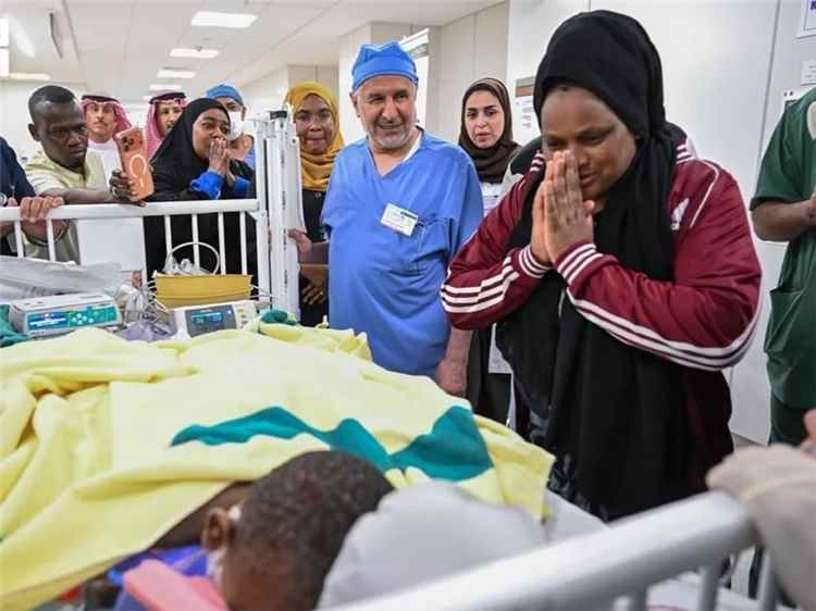 فصل التوأم التنزاني في السعودية بعد عملية استمرت 14 ساعة