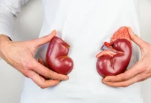 تنظيف الكلى اليك اهم الخضروات