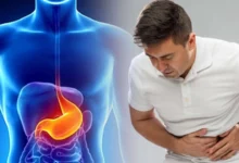 علاج القرحة المعدية تشمل عرق السوس، زنجبيل، كركم، بابونج، ثوم، ألوفيرا، وحلبة