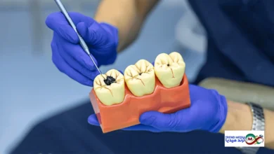 الشاي الأخضر ضد تسوس الأسنان