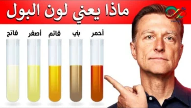 درجات لون البول وتشخيص الامراض