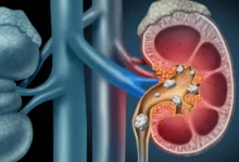 حمض البوليك