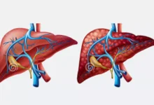 اكتشاف مذهل: حلوى لذيذة قد تنقذ الكبد من مرض العصر! (جربها بنفسك) 12 الكبد
