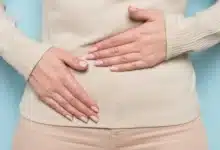 عشبة الأعجوبة