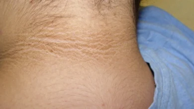 الشواك الأسود