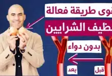 تذيب دهون الشرايين