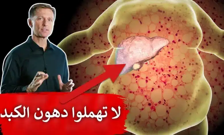 دهون الكبد