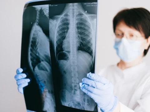 معجزة في كوب: خلطة أعشاب سرية تنظف رئتيك من السموم وتعيد تنفسك طبيعياً في 7 أيام فقط! 5 تنظف رئتيك من السموم