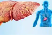 أخطاء تدمر الكبد