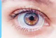 شبكية العين