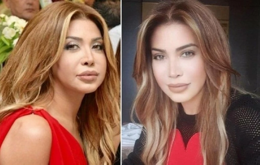 بعد مأساة رحمة حسن.. «ترند ميديا» ترصد فنانات وقعن في فخ عمليات التجميل! 3 56675675678678