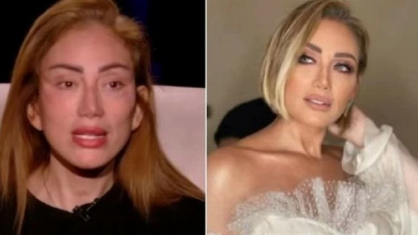 بعد مأساة رحمة حسن.. «ترند ميديا» ترصد فنانات وقعن في فخ عمليات التجميل! 2 5675675676778