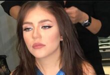 رحمة حسن عملية تجميل