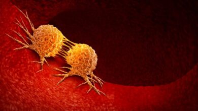 tbl articles article 1793 284c04fab8a ae2c 456f 8ff8 a194d8187a9d