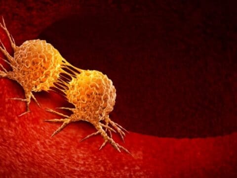 أسباب السرطان القابلة للوقاية: دراسة عالمية تكشف 6 عادات ترفع خطر الإصابة 1 tbl articles article 1793 284c04fab8a ae2c 456f 8ff8 a194d8187a9d