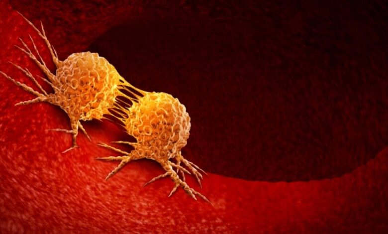 tbl articles article 1793 284c04fab8a ae2c 456f 8ff8 a194d8187a9d