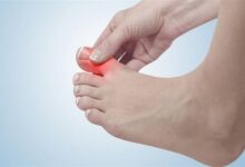 أعراض سرطان العظام في القدم