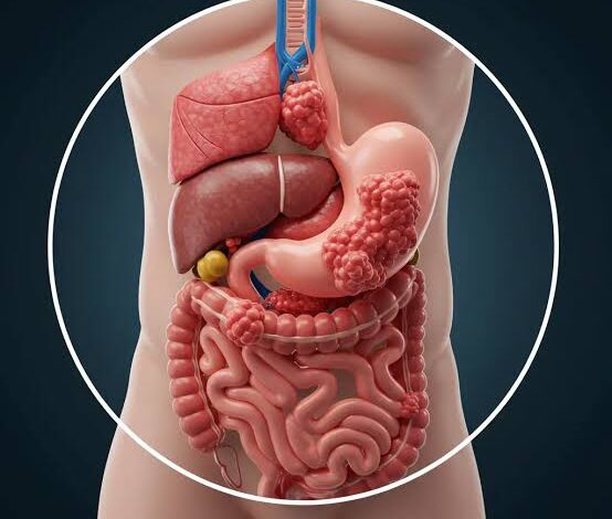 علامات سرطان القولون على الجلد: 5 أعراض جلدية لا تتجاهلها قد تنقذ حياتك 1 images 17