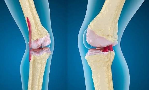 أعشاب رخيصة لمرضى السكر والمفاصل: الحلبة والقرفة والكركم.. هل تبني الغضاريف حقاً؟ 8 images 6