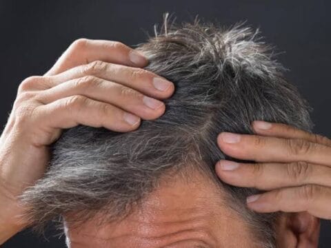 علاج الشيب طبيعياً: 5 وصفات منزلية مجربة 7 علاج الشيب طبيعياً