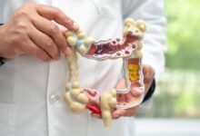 تنظيف القولون طبيعياً