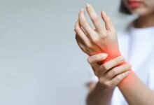 Treating arthritis with turmeric
