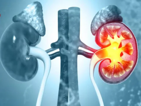 تخلّص من ألم حصوة الكلى فوراً! 7 طرق منزلية مذهلة لعلاجها<title>حصوة الكلى: رحلة العلاج من المنزل إلى غرفة العمليات</title> 8 kidney stone