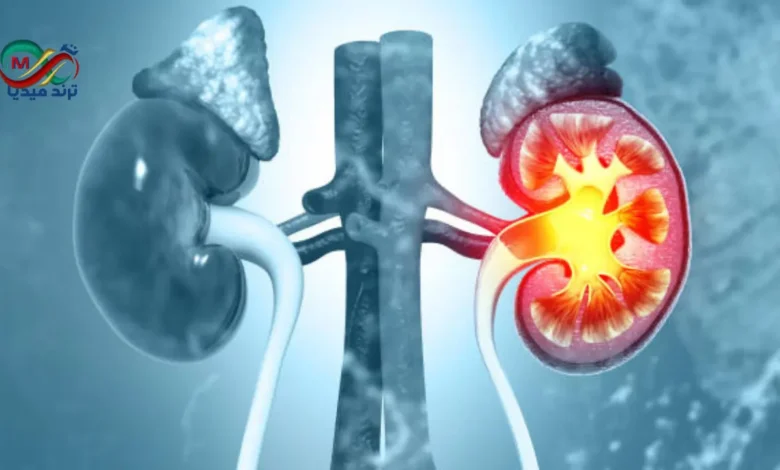 kidney stone