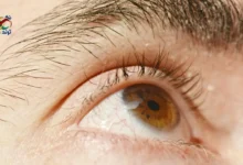 eye health