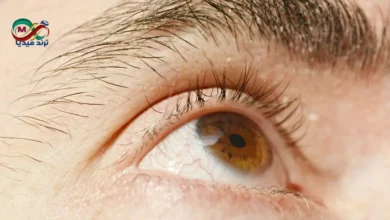 eye health
