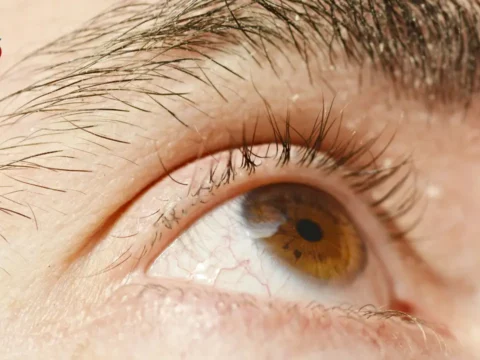 eye health