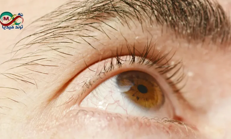 مشروب طبيعي لصحة العين.. هل يساعد في تقليل خطر إعتام عدسة العين؟ 10 eye health