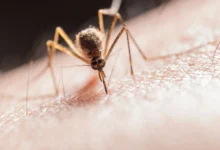 mosquito bites.