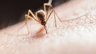 mosquito bites.