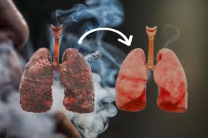 تنظيف الرئتين من آثار التدخين