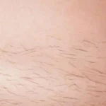 شعر المنطقة الحساسة: لماذا ينمو وما أهميته للجسم وفق العلم؟ 11 4234345345456