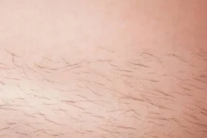 شعر المنطقة الحساسة: لماذا ينمو وما أهميته للجسم وفق العلم؟ 7 4234345345456