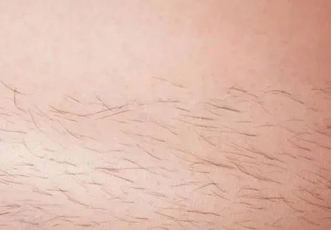 شعر المنطقة الحساسة: لماذا ينمو وما أهميته للجسم وفق العلم؟ 1 4234345345456