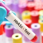 تحليل السكر التراكمي HbA1c وقياس مستوى سكر الدم